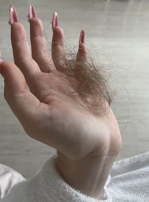 Нормально ли что только после расчесывания выпадает столько волос?