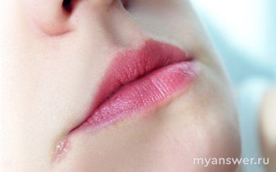 Как избавиться от заед после поцелуев?