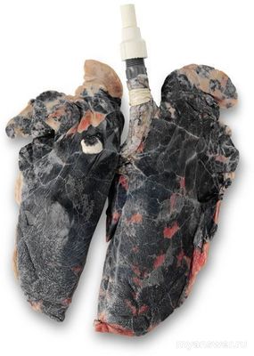 Почему курить вредно, а пить Колу нет?