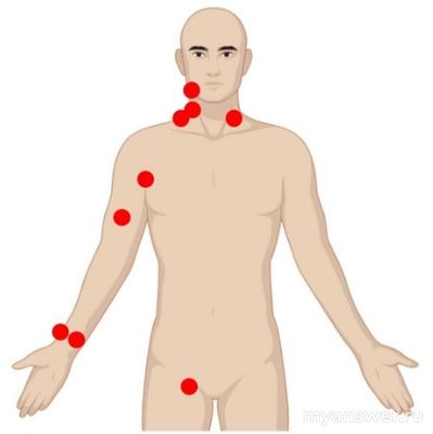 Ответ на задание об остановке кровотечения в середине предплечья где найти?