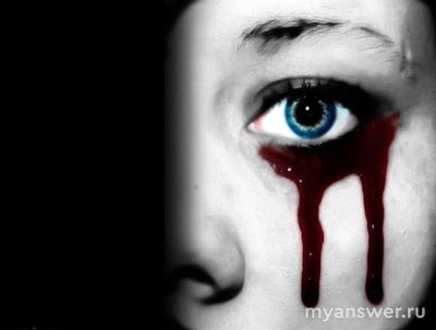 Может ли у человека идти кровь из глаз в прямом смысле?