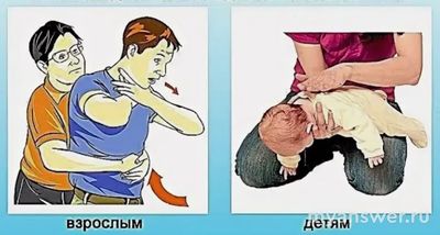 Как оказать первую помощь при попадании инородного тела в верхние дых.пути?