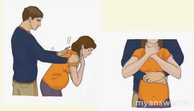 Как оказать первую помощь при попадании инородного тела в верхние дых.пути?