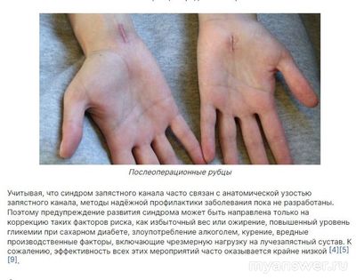 Немеют безымянный палец и мизинец правой руки, какие причины?