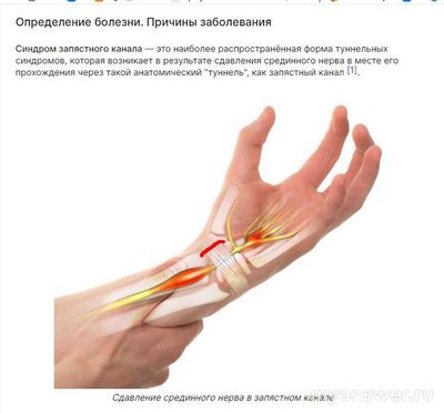 Немеют безымянный палец и мизинец правой руки, какие причины?