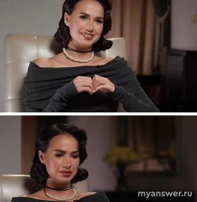 Зачем Алина Загитова закачала филлеры в губы?